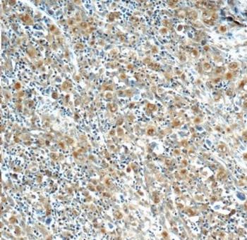 IL21R Rabbit Polyclonal Antibody