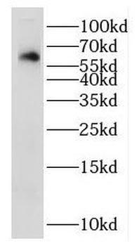 IL22RA1 Rabbit Polyclonal Antibody