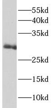 IL22RA2 Rabbit Polyclonal Antibody