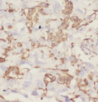 IL22RA2 Rabbit Polyclonal Antibody