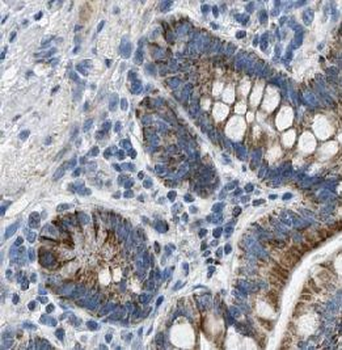 IL31 Rabbit Polyclonal Antibody