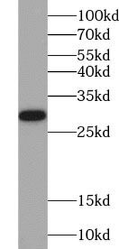 IL32 Rabbit Polyclonal Antibody