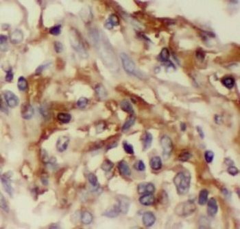 IL32 Rabbit Polyclonal Antibody