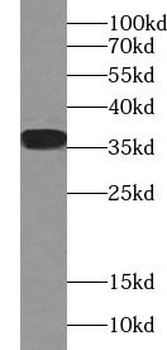 IL33 Mouse Monoclonal Antibody