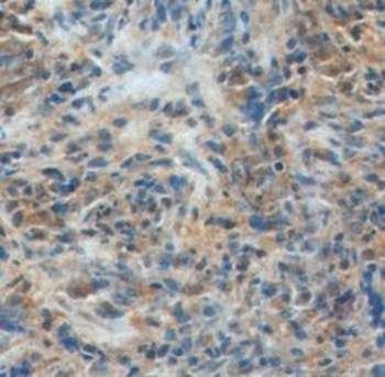 IL33 Mouse Monoclonal Antibody