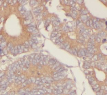 IL37 Rabbit Polyclonal Antibody