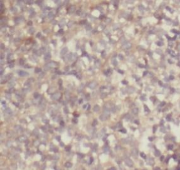 IL4 Mouse Monoclonal Antibody