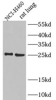 IL6 Rabbit Polyclonal Antibody