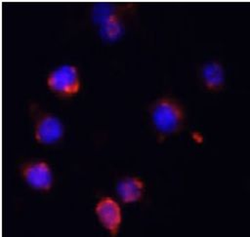 IL6 Rabbit Polyclonal Antibody