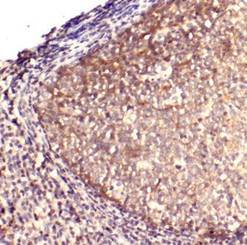 IL6 Rabbit Polyclonal Antibody
