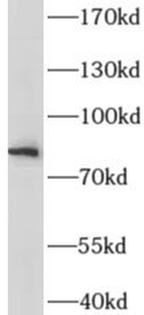 IL6R Rabbit Polyclonal Antibody