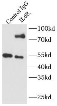 IL6R Rabbit Polyclonal Antibody