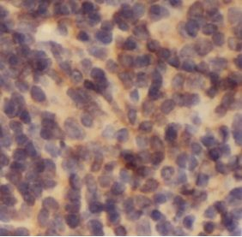 IL6R Rabbit Polyclonal Antibody