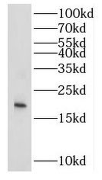 IL9 Rabbit Polyclonal Antibody