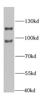 ILF3 Rabbit Polyclonal Antibody