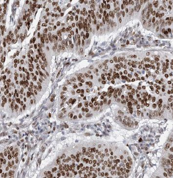 ILF3 Rabbit Polyclonal Antibody
