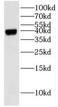 BPNT2 Rabbit Polyclonal Antibody