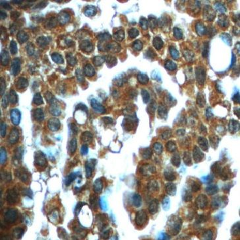 IMPDH1 Rabbit Polyclonal Antibody