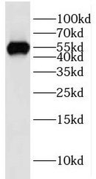 IMPDH2 Rabbit Polyclonal Antibody