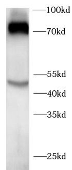 INHBB Rabbit Polyclonal Antibody