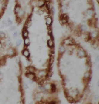 INHBB Rabbit Polyclonal Antibody