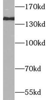 INPP5D Rabbit Polyclonal Antibody