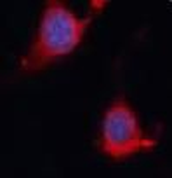 INPP5D Rabbit Polyclonal Antibody