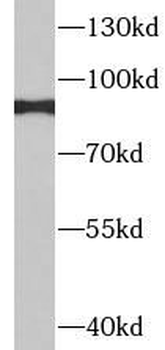 ITGB7 Rabbit Polyclonal Antibody