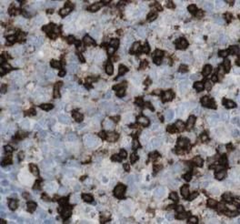 ITGB7 Rabbit Polyclonal Antibody