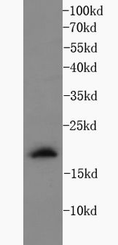 IFNG Rabbit Polyclonal Antibody