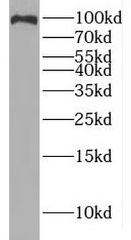 IREB2 Rabbit Polyclonal Antibody