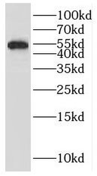 IRF4 Rabbit Polyclonal Antibody