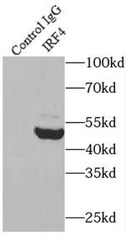 IRF4 Rabbit Polyclonal Antibody