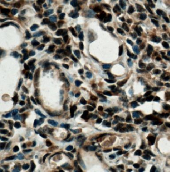 IRF4 Rabbit Polyclonal Antibody