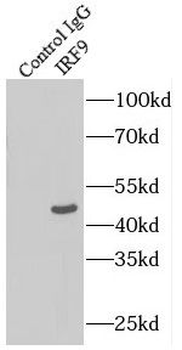 IRF9 Rabbit Polyclonal Antibody