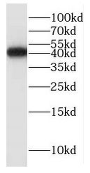 ITGB1BP2 Rabbit Polyclonal Antibody