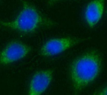 ITGB1BP2 Rabbit Polyclonal Antibody