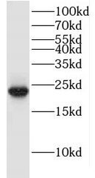 ITPA Rabbit Polyclonal Antibody