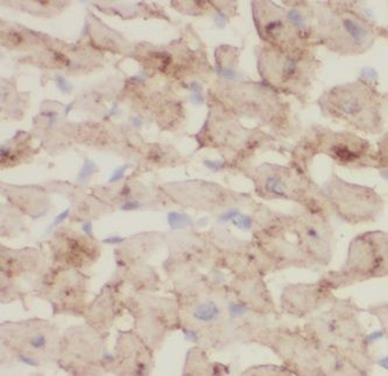 ITPA Rabbit Polyclonal Antibody