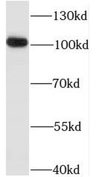ITPKC Rabbit Polyclonal Antibody