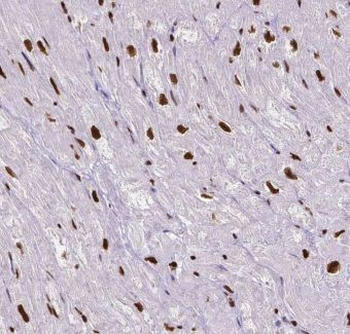 ITPKC Rabbit Polyclonal Antibody