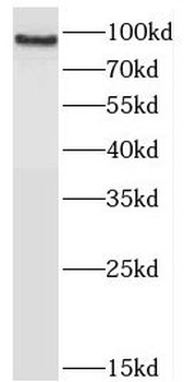 JAKMIP2 Rabbit Polyclonal Antibody