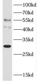 JAML Rabbit Polyclonal Antibody