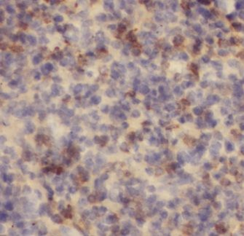 JAML Rabbit Polyclonal Antibody