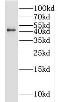JUNB Rabbit Polyclonal Antibody
