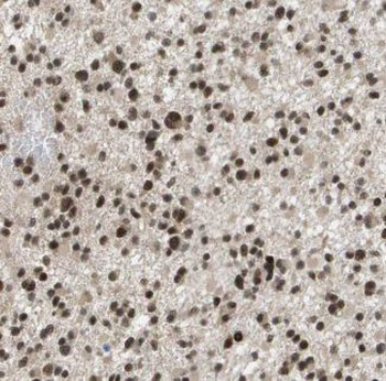 JUNB Rabbit Polyclonal Antibody