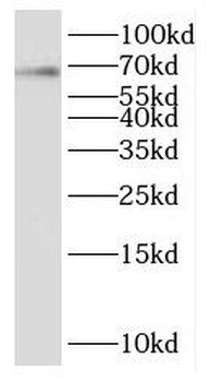 KCNA5 Rabbit Polyclonal Antibody