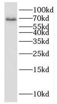 KCNAB1 Rabbit Polyclonal Antibody