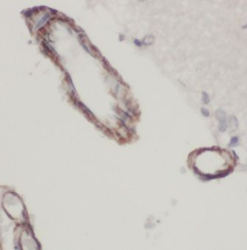 KCNAB1 Rabbit Polyclonal Antibody