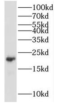 KCNE1 Rabbit Polyclonal Antibody